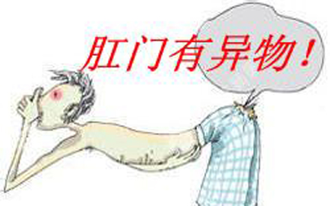 肛门有异物怎么办