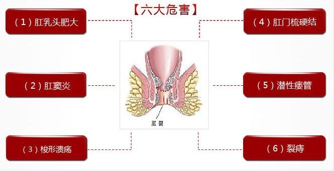 女性得了肛裂有什么危害