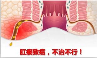 肛瘘的症状有哪些