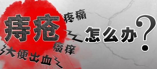 治疗外痔可以不住院吗