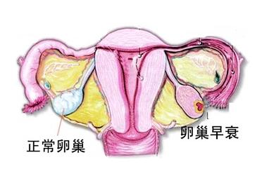卵巢早衰能治好吗