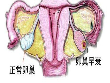 卵巢早衰的原因有哪些