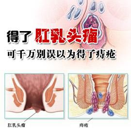 如何预防肛乳头瘤最有效