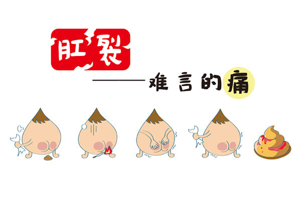 肛裂