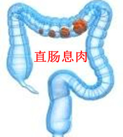是什么原因引起的