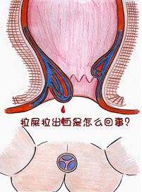 拉血是什么症状